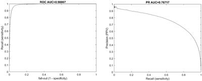 Hypoglycemia event prediction from CGM using ensemble learning